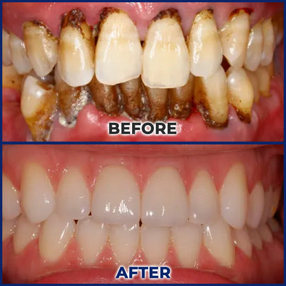 Gloveio® BeeTakt Bee Venom Dental Treatment Drops Mouthwash