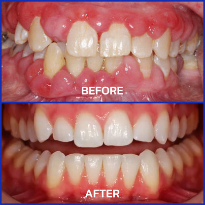 Gloveio® VioCore Bee Venom Dental Treatment Toothpaste