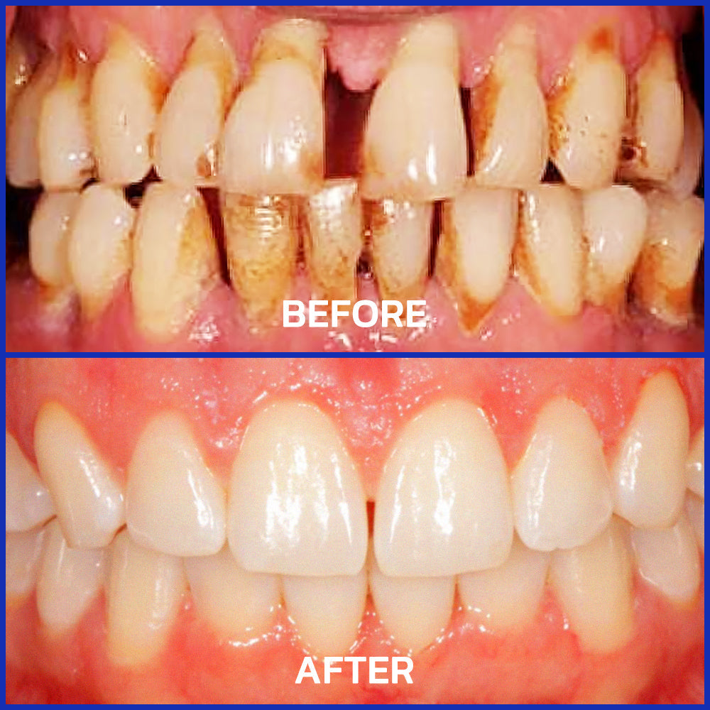 Gloveio® VioCore Bee Venom Dental Treatment Toothpaste